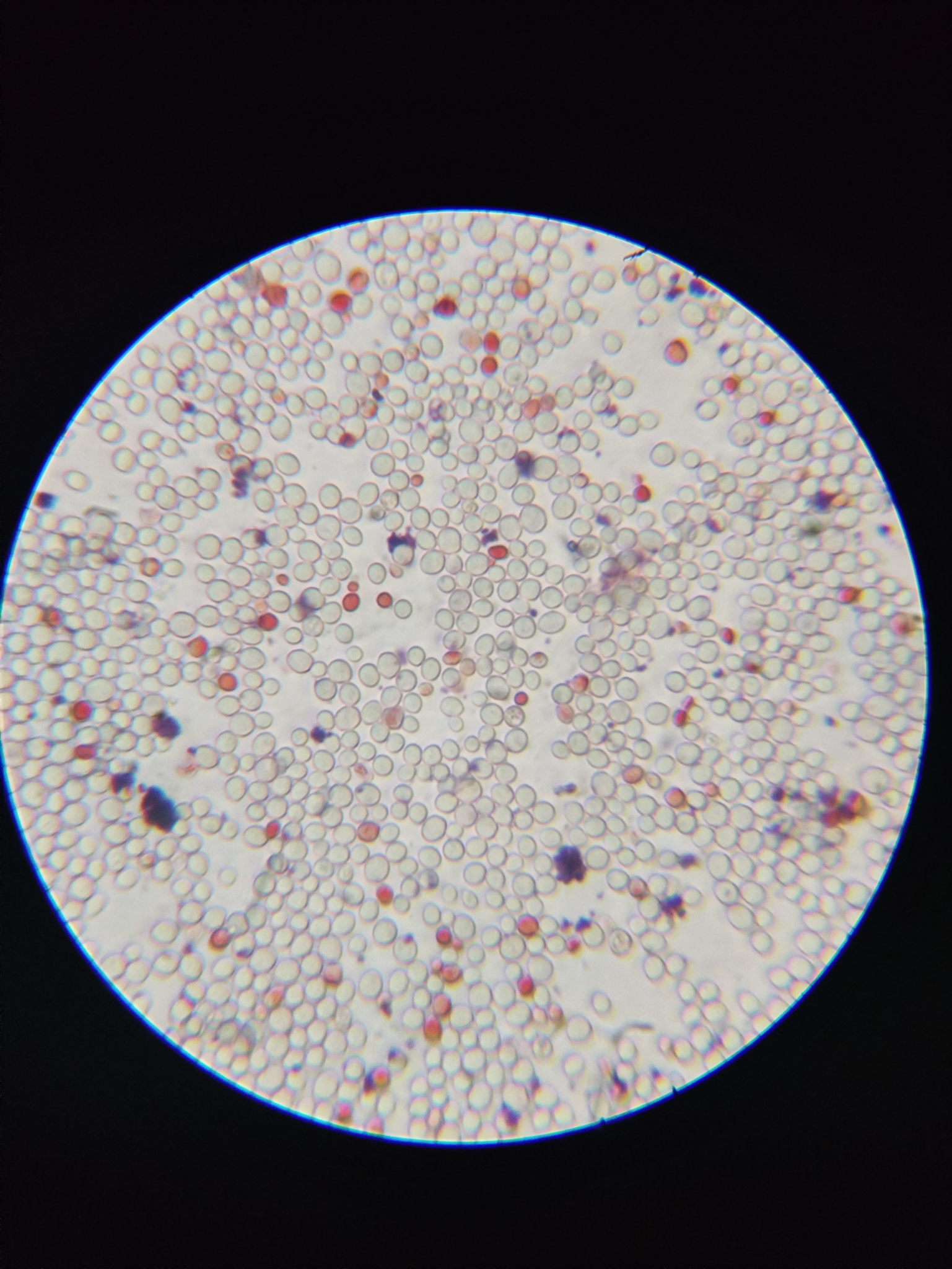 Baker's Yeast